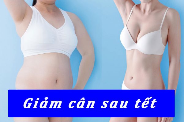 Giảm cân sau tết không khó khi bạn tìm đúng giải pháp