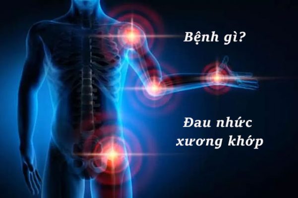 Triệu chứng đau nhức xương khớp là dấu hiệu của bệnh gì?