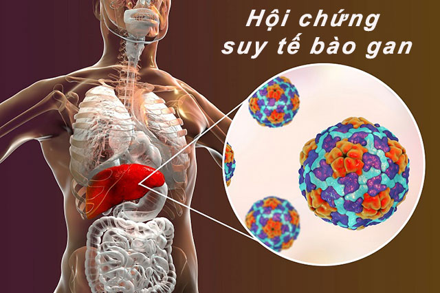 Bạn đã biết đến Hội chứng suy tế bào gan?