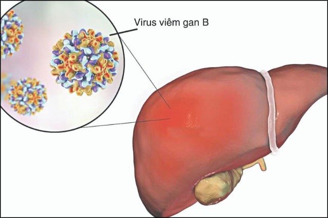Virus viêm gan B ảnh hưởng đến cấu tạo của gan