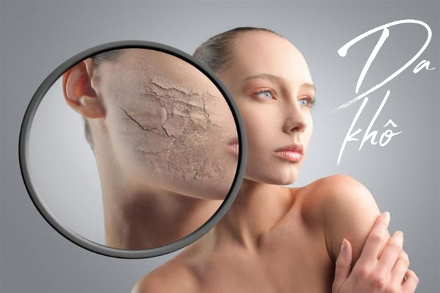 Cách nhận biết loại da khô và chăm sóc da khô đúng cách
