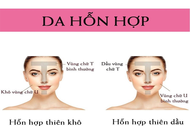 Nhận biết da hỗn hợp và cách chăm sóc phù hợp