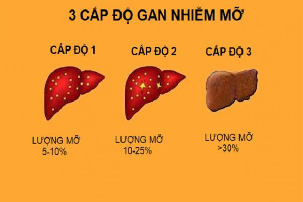 Bệnh gan nhiễm mỡ là gì?