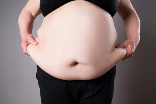 Bệnh béo phì được định nghĩa như thế nào?