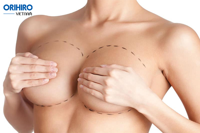 Tiêu chuẩn bầu ngực đẹp còn được xác định bởi đường cong uốn nhẹ nhàng