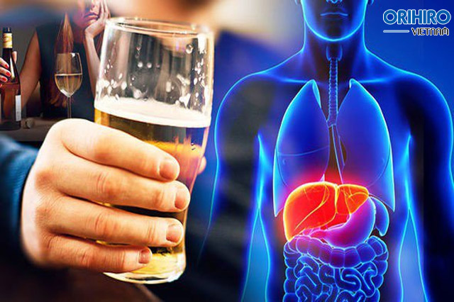 Uống rượu bia ảnh hưởng đến gan như thế nào?