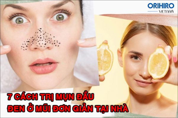 Tiết lộ 7 cách trị mụn đầu đen ở mũi đơn giản và hiệu quả tại nhà