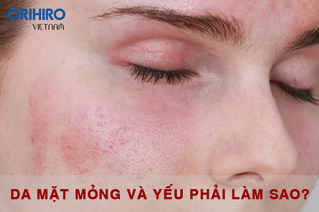 Phục hồi da mặt mỏng và yếu với mặt nạ thiên nhiên cực đơn giản