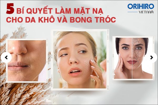 5 bí quyết làm mặt nạ cho da khô và bong tróc hiệu quả nhất