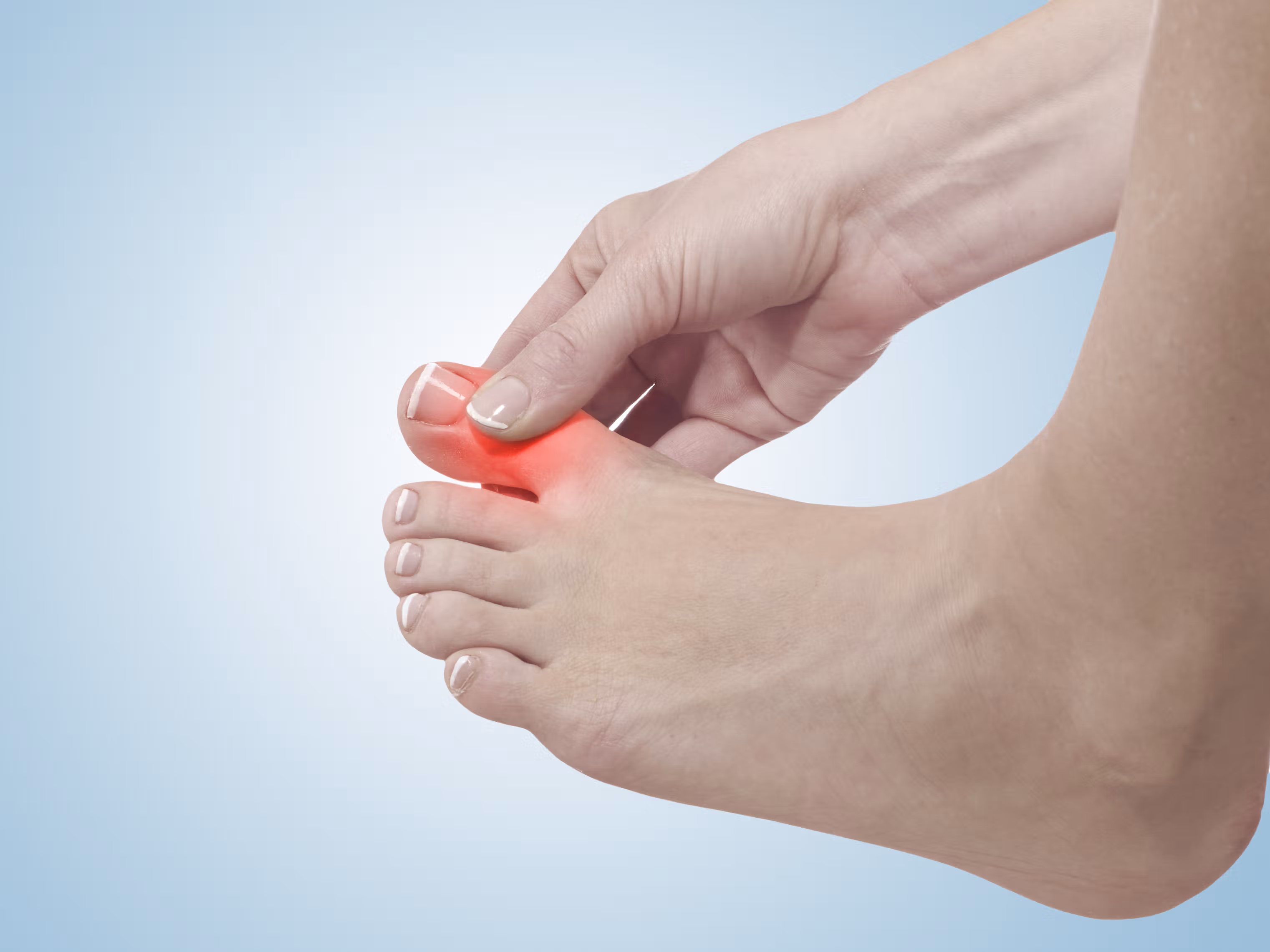 Đau ngón chân cái - dấu hiệu điển hình cho thấy Gout không chỉ gặp ở người lớn tuổi