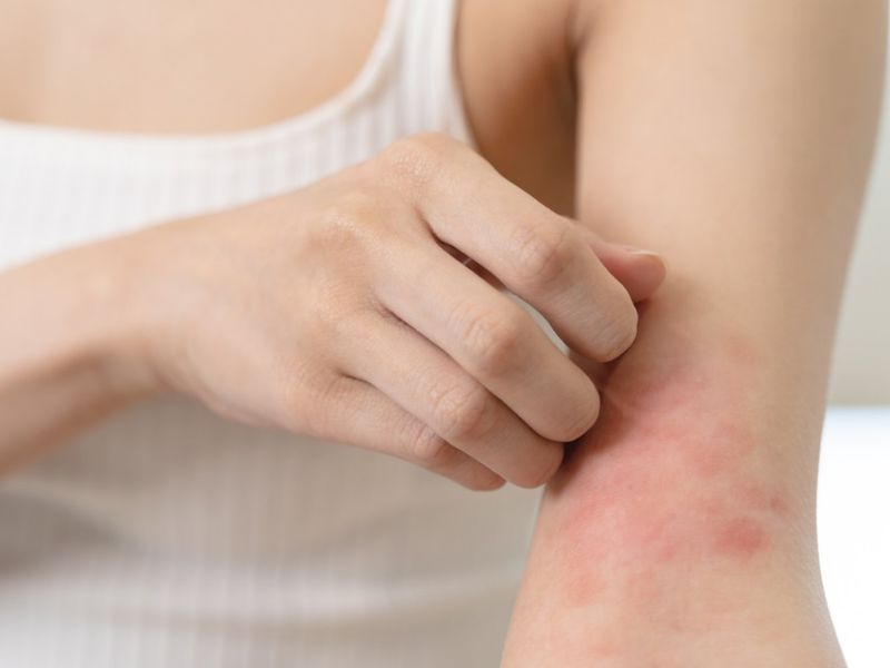Da ngứa âm ỉ - cảnh báo lá gan bị tổn thương