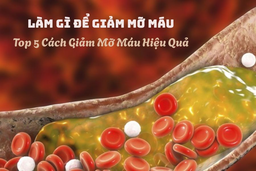 Làm Gì Để Giảm Mỡ Máu? Top 5 Cách Giảm Mỡ Máu Hiệu Quả