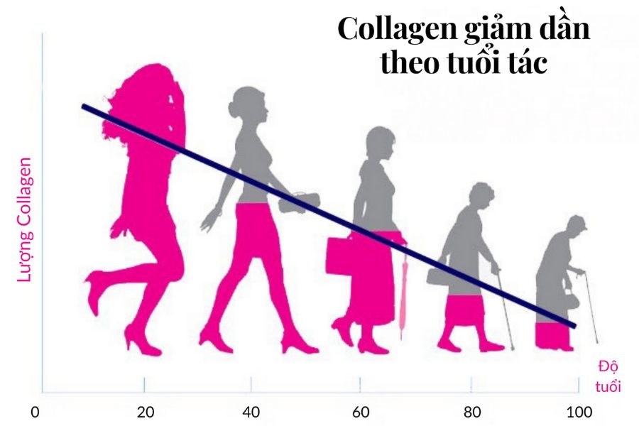 Collagen giảm theo thời gian gây lão hóa da